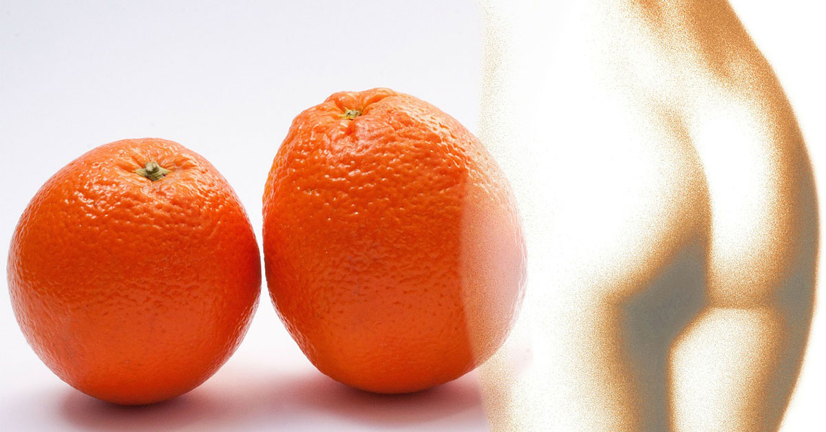 orangenhaut